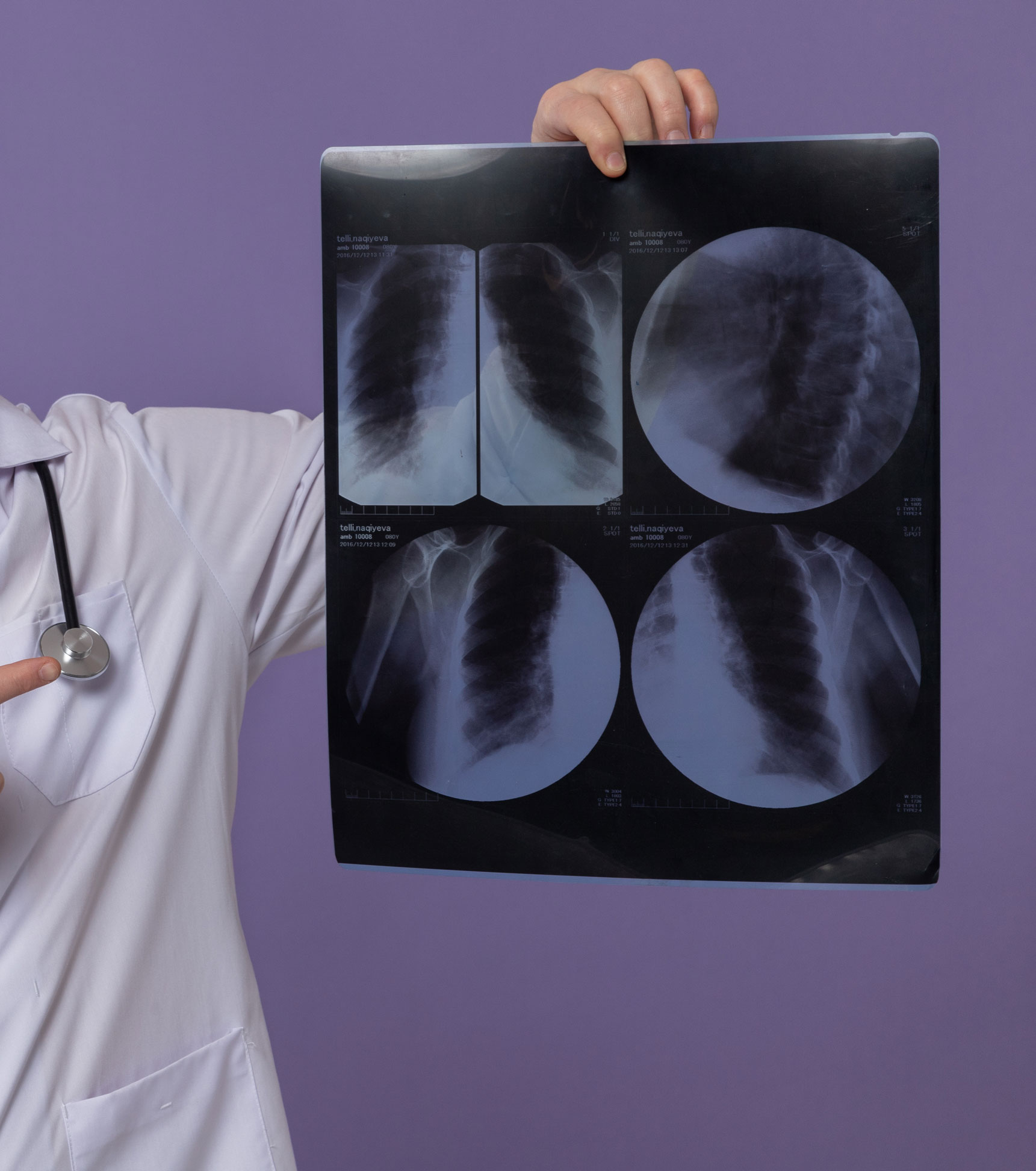 הרופא מביטוח הלאומי